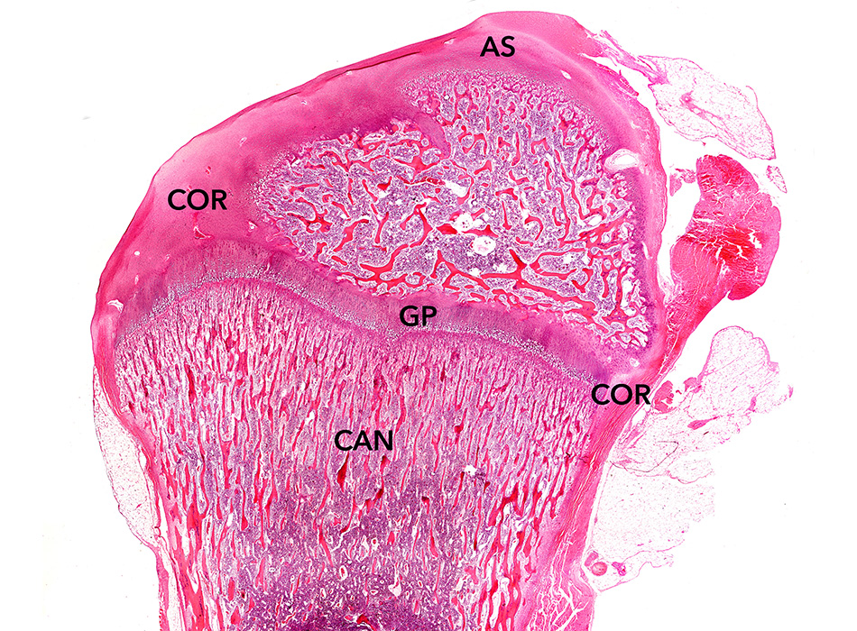 Cancellous vs Cortical