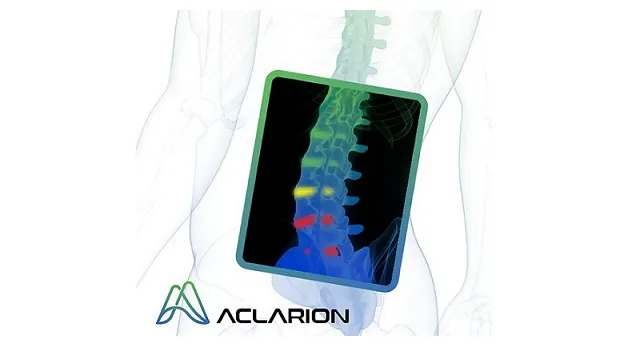 Aclarion Announces Signing of Commercial Agreement with Porter Hospital, an AdventHealth Facility, to Bring Nociscan Technology to Denver