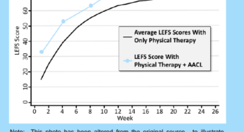 Find out how your ACL recovery is going