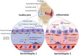 Fibroblast multiplicity in RA: a synovial state of the art