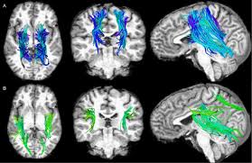 download 2026 03 25T192838.519