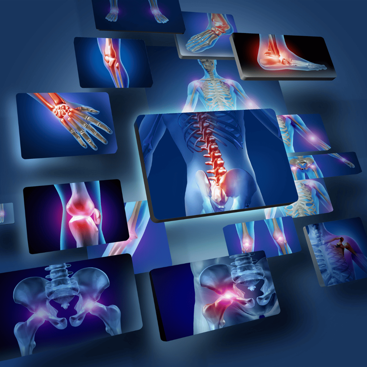 osteocytes