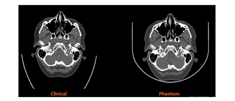 Stratasys is collaborating with Siemens Healthineers in a Landmark Research Project to advance medical imaging