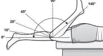Knee Decreased Range of Motion