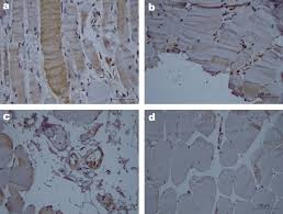 YKL-40 serum levels are predicted by inflammatory state, age, and diagnosis of idiopathic inflammatory myopathies