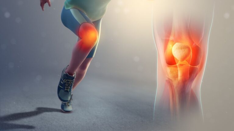 Living with Knee Pain: Understanding Arthritis