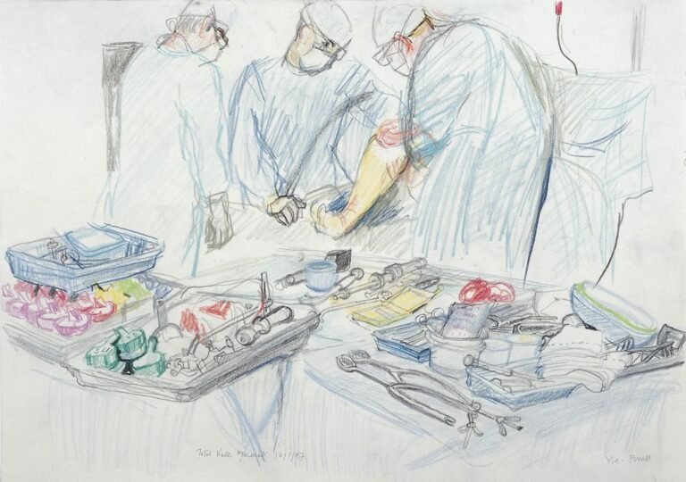 The Benefits of Titanium Knee Replacement