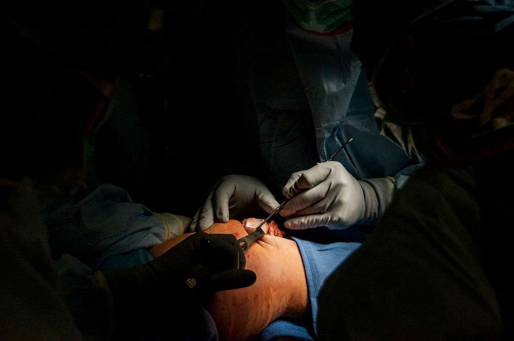 The Benefits of Double Knee Replacement Surgery