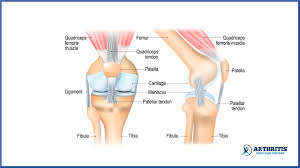 Understanding Patella Pain When Straightening Leg