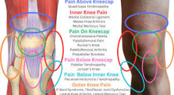 Inner Knee Pain: Causes, Treatments & Prevention