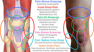 Inner Knee Pain: Causes, Treatments & Prevention