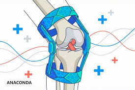 Criteria-Based Recovery vs. The 9-Month Rule: What Actually Determines When Your Knee Is Ready?