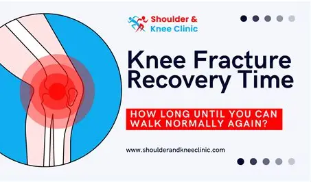 FIFA Tournament Knee Recovery Timeline: A Complete Guide for Players and Coaches