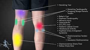 Back of knee pain causes in 2026: Common reasons, warning signs, and what helps